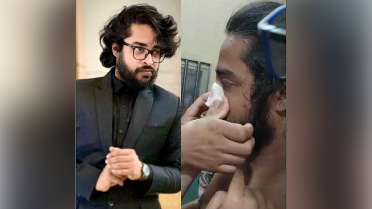 আহত আল নাহিয়ান। ছবি : সংগৃহীত