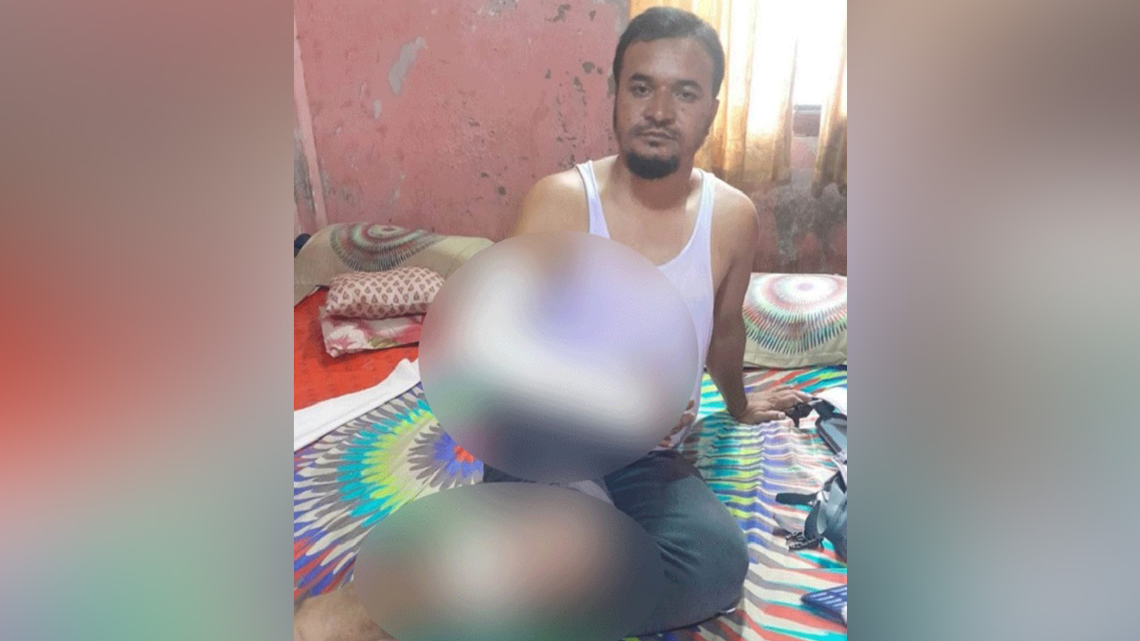 হাতুড়িপেটায় আহত সাংবাদিক কলি হাসান। ছবি : কালবেলা