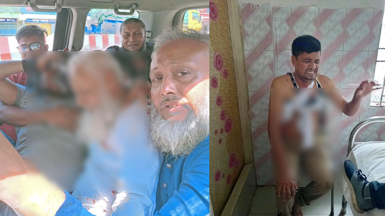 কুমিল্লায় লাকসামে বিএনপির গাড়িবহরে হামলার ঘটনায় আহত নেতাকর্মী। ছবি : কালবেলা
