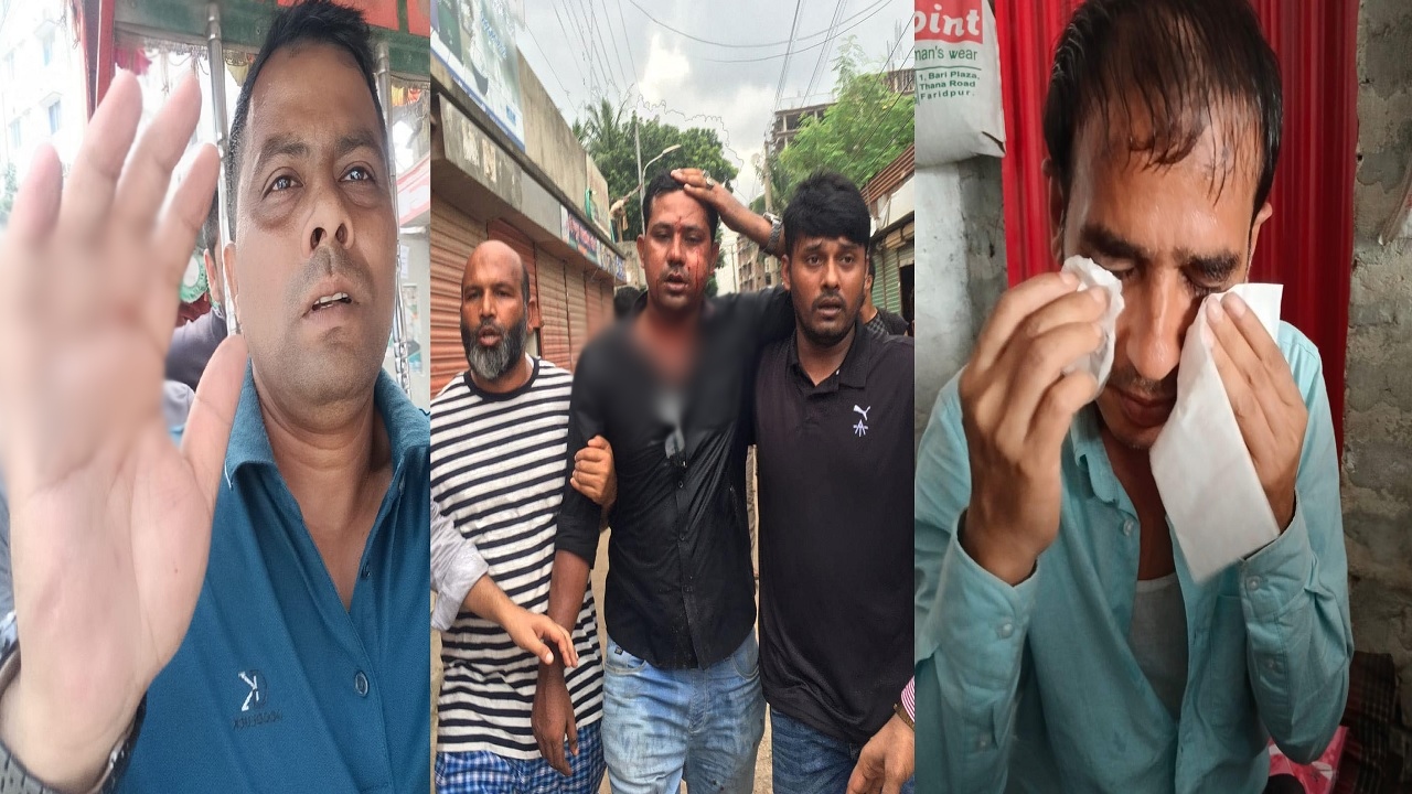 বিএনপির কর্মসূচি ঘিরে জাতীয়তাবাদী ছাত্রদলের আহত নেতাকর্মীদের কয়েকজন।