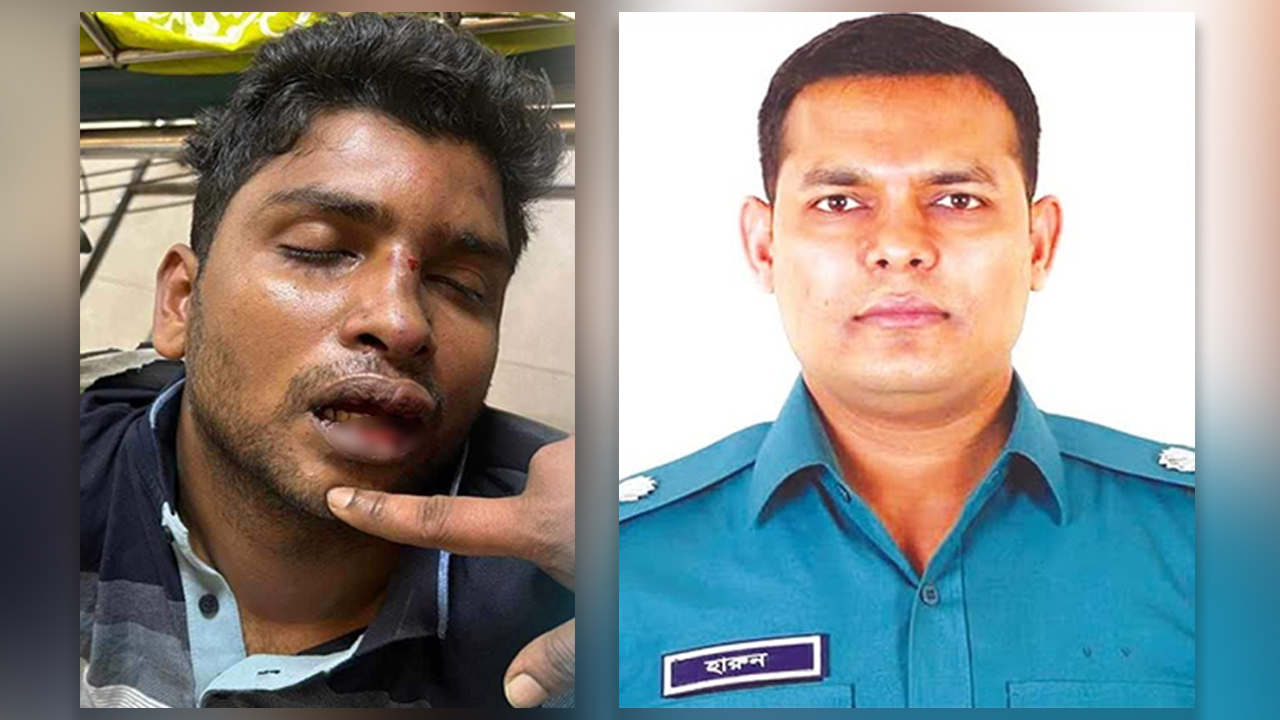 আহত ছাত্রলীগ নেতা আনোয়ার হোসেন নাঈম, রমনা বিভাগের এডিসি হারুন অর রশিদ। ছবি: সংগৃহীত