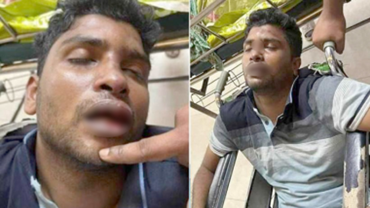 ঢাকা বিশ্ববিদ্যালয়ের ফজলুল হক হলের সভাপতি আনোয়ার হোসেন নাঈম। ছবি : সংগৃহীত