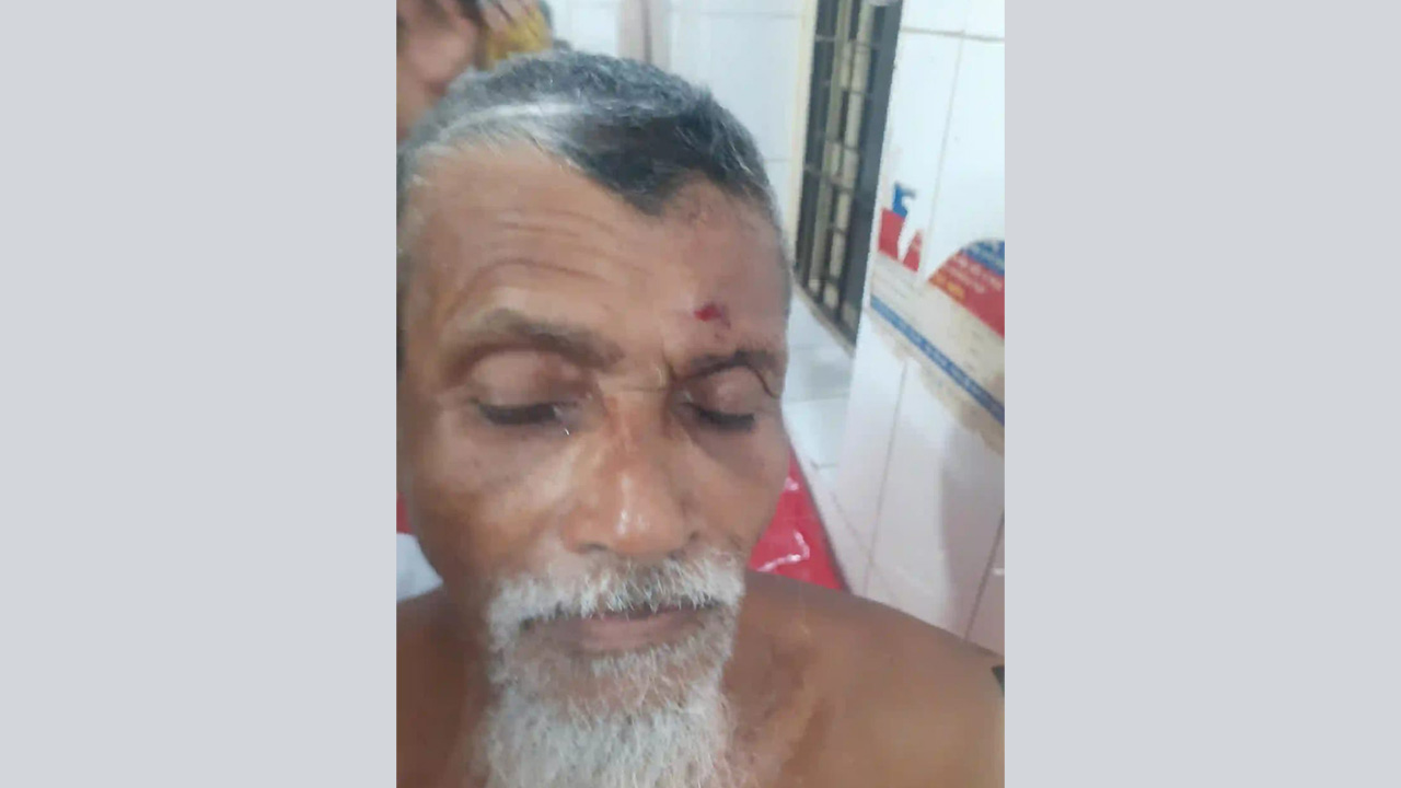 আহত মুয়াজ্জিন নুরুল ইসলাম লেদু। ছবি : কালবেলা