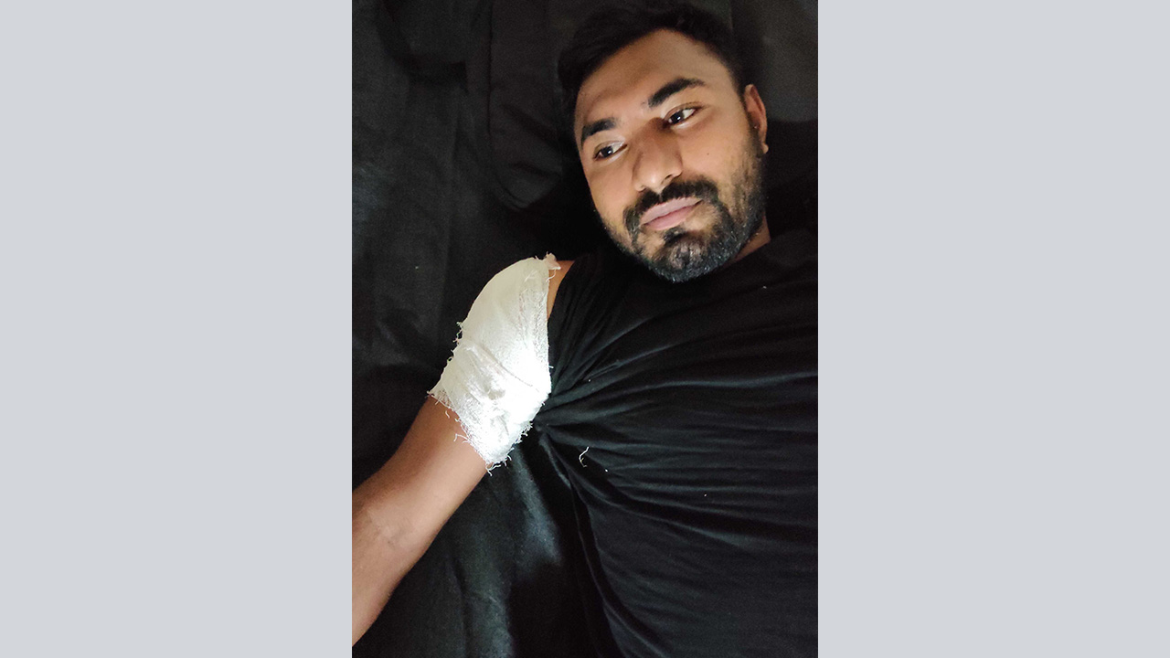 আহত যবিপ্রবির শিক্ষার্থী আদনান । ছবি : কালবেলা