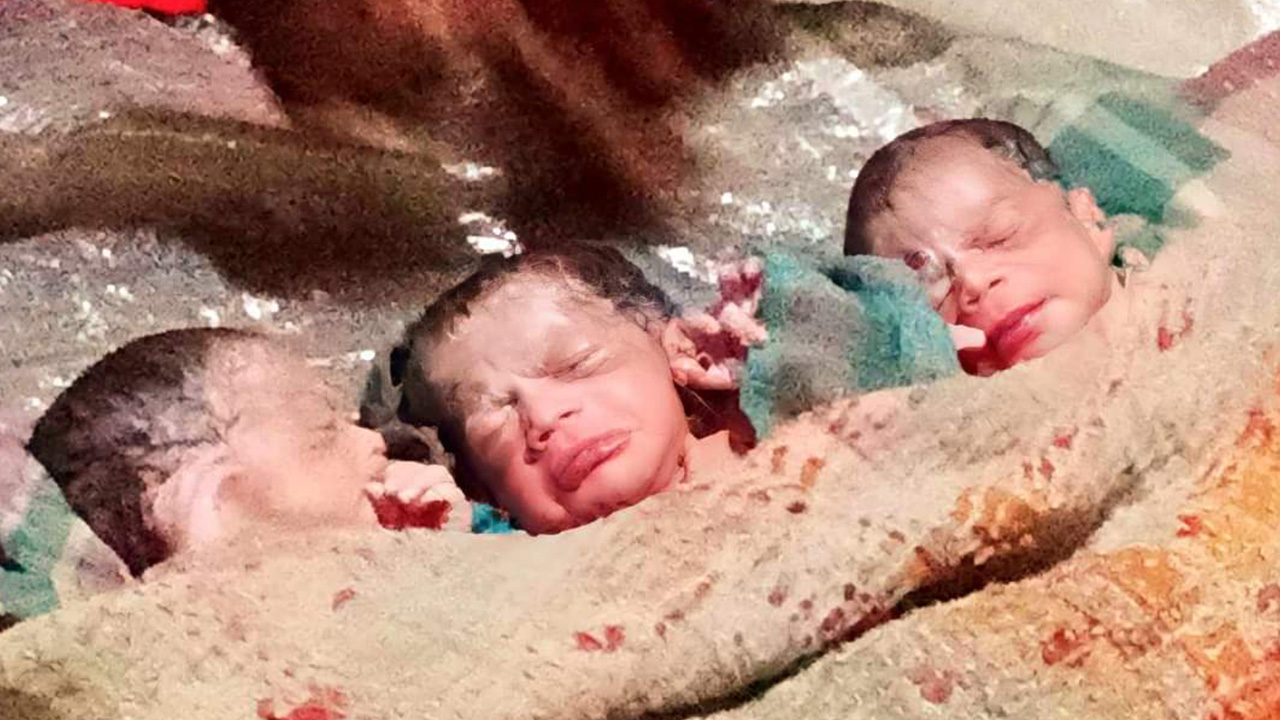 জামালপুরের বকশীগ‌ঞ্জে একসঙ্গে তিন সন্তান প্রসব। ছবি : কালবেলা