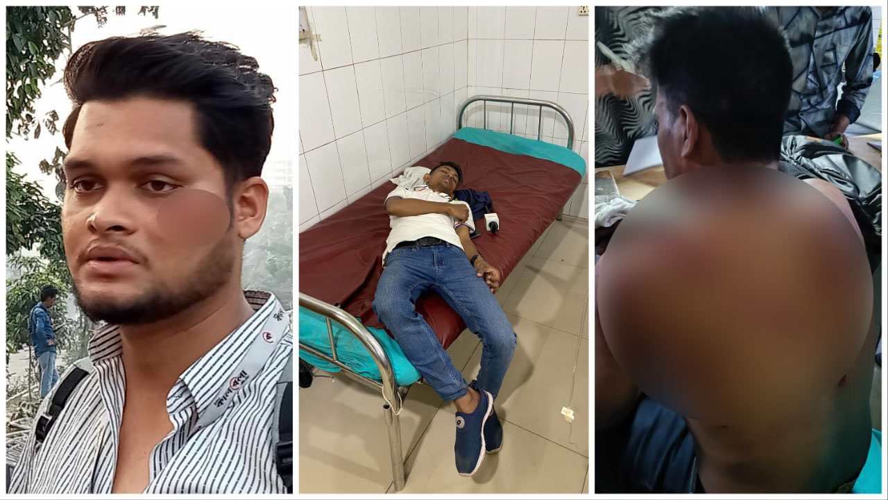 বাম থেকে আহত কালবেলার সাংবাদিক তারেক, মুসা ও রাফসান জানি। ছবি : কালবেলা