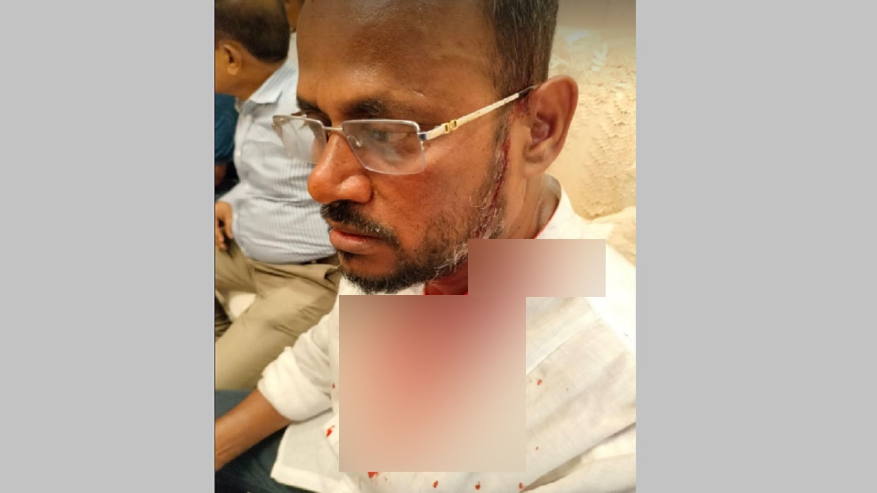 আহত যুবদলের সভাপতি সালাউদ্দিন টুকু। ছবি : সংগৃহীত