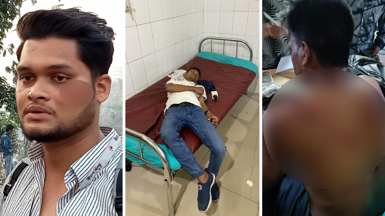 বাঁ থেকে আহত কালবেলার সাংবাদিক তারেক, মুসা ও রাফসান জানি। ছবি : কালবেলা