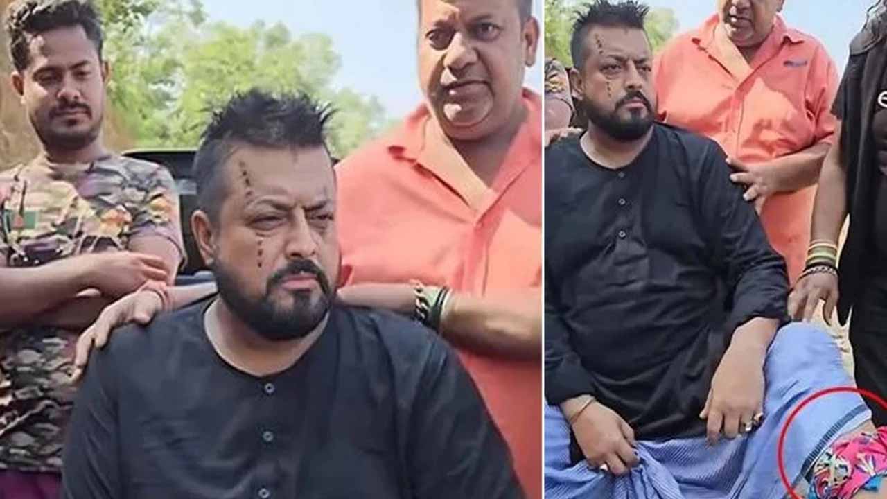 আহত ওমর সানী। ছবি : সংগৃহীত