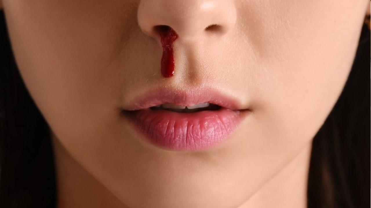 নাক দিয়ে রক্ত পড়ছে । ছবি : সংগৃহীত