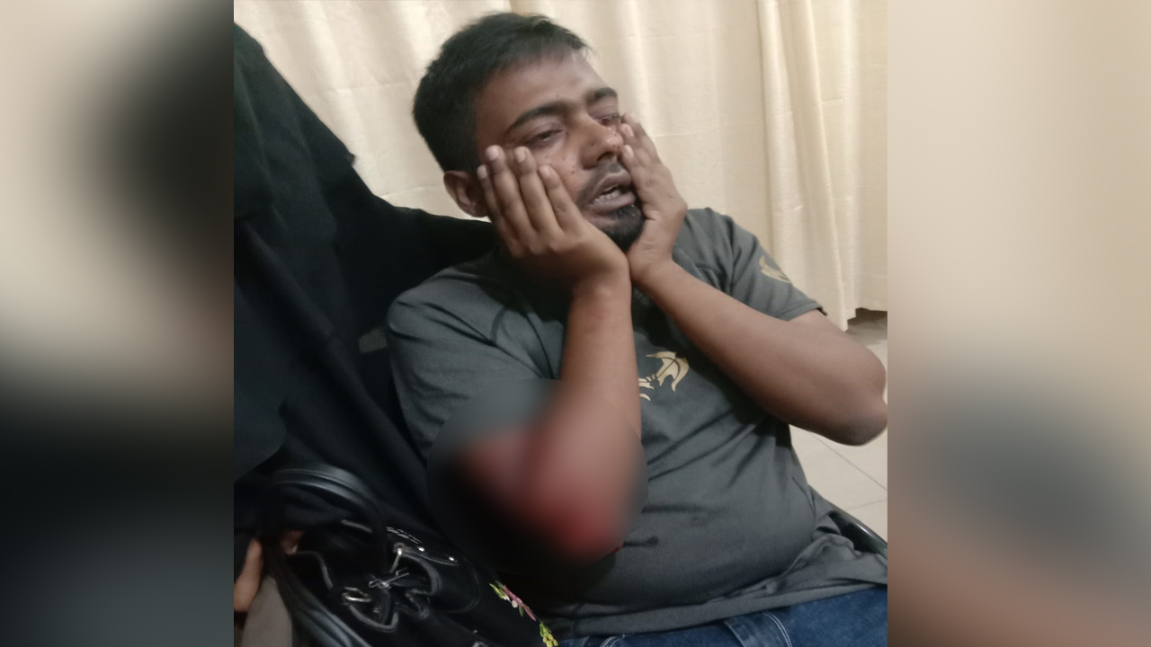 অবরোধকারীদের ছোড়া ককটেলে চোখ হারাতে বসেছেন আবুল বাসার। ছবি : কালবেলা