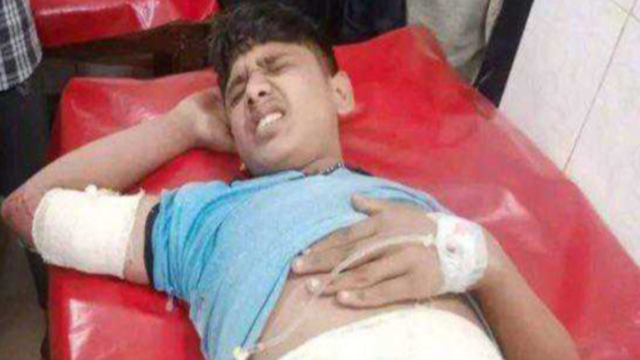 আহত শাহপরান। ছবি : কালবেলা