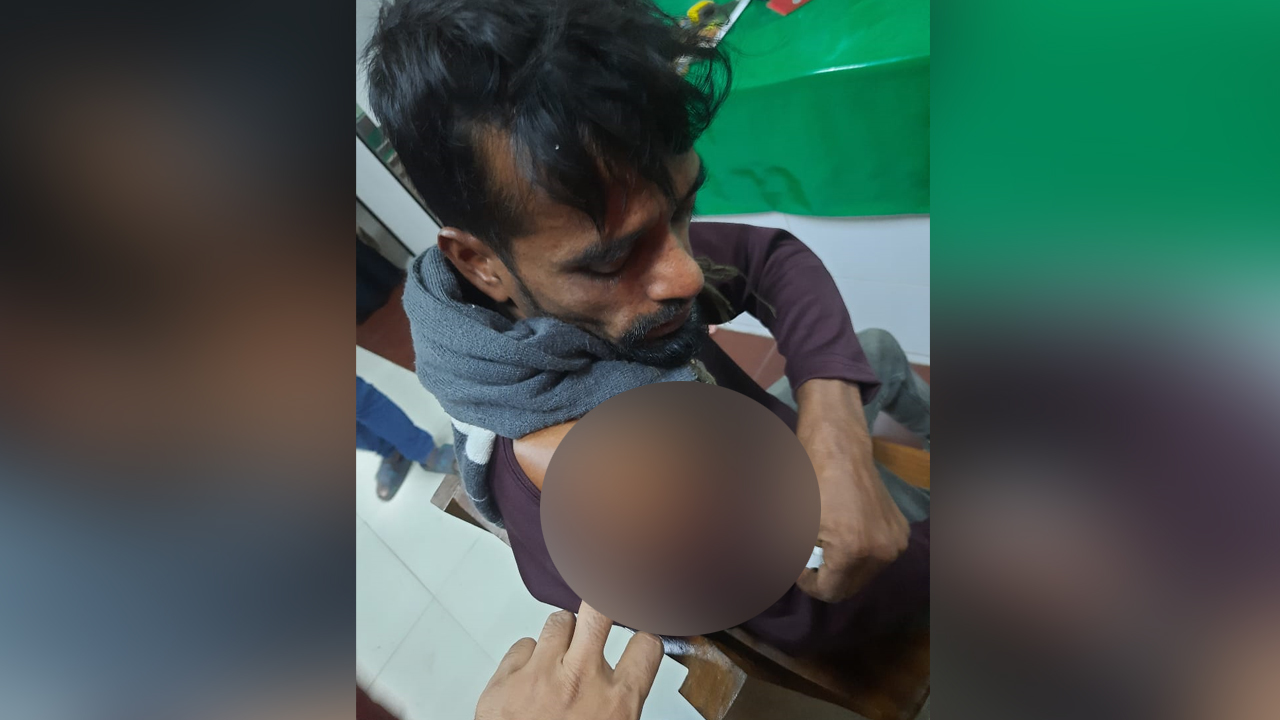 গুলিবিদ্ধ একজন ক্ষতস্থান দেখাচ্ছেন। ছবি : কালবেলা
