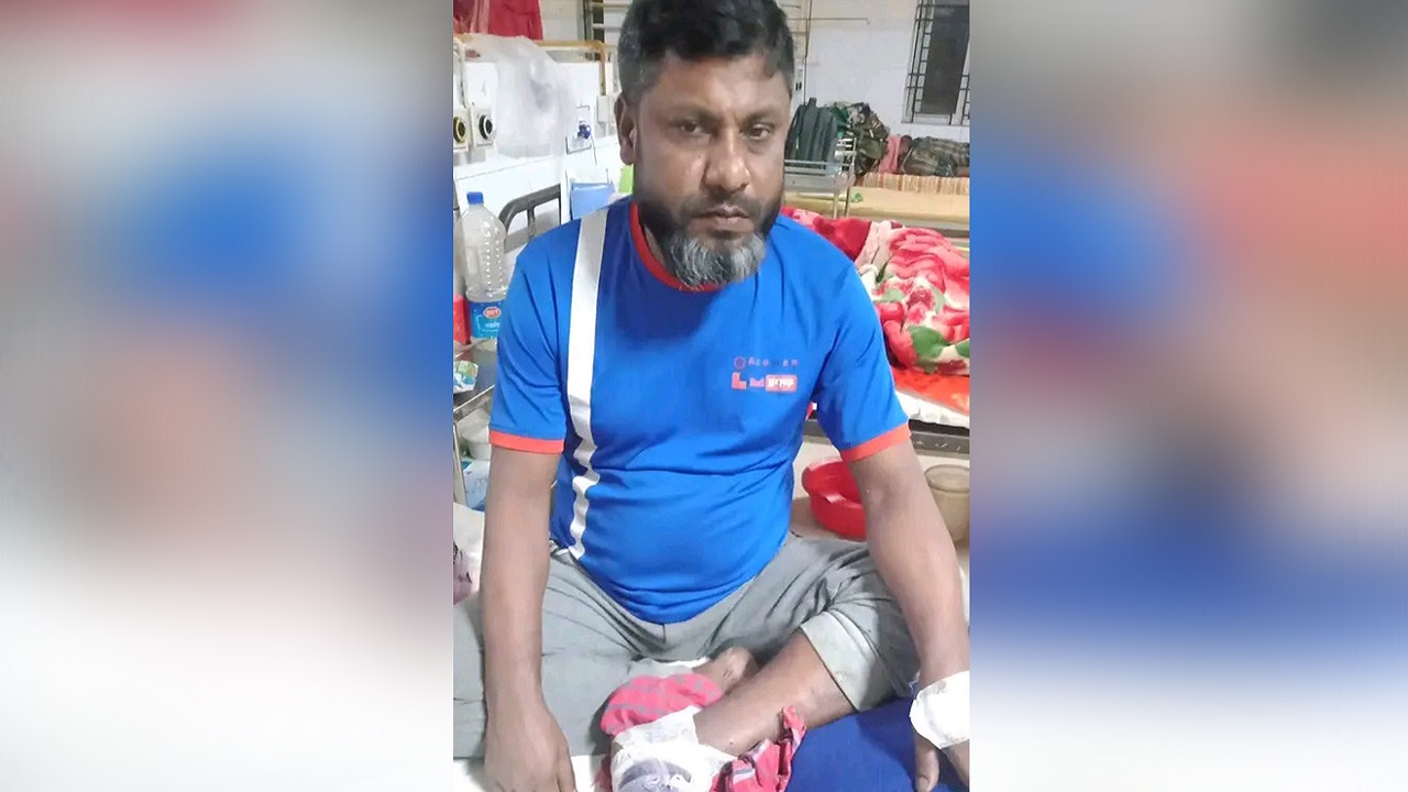 আহত চা দোকানি। ছবি : কালবেলা