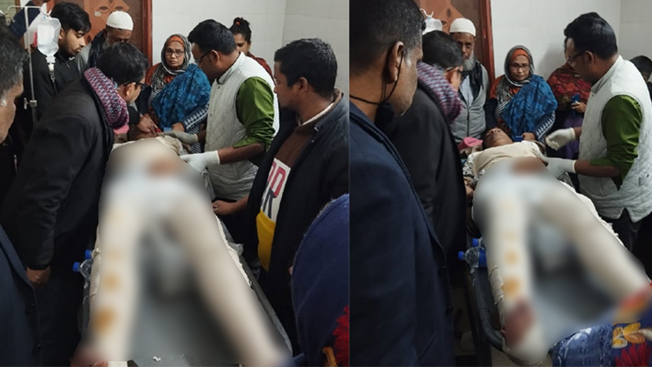 অবস্থার অবনতি হলে কর্তব্যরত চিকিৎসক উন্নত চিকিৎসার জন্য তাকে ঢাকা পঙ্গু হাসপাতালে রেফার্ড করেন। ছবি : কালবেলা
