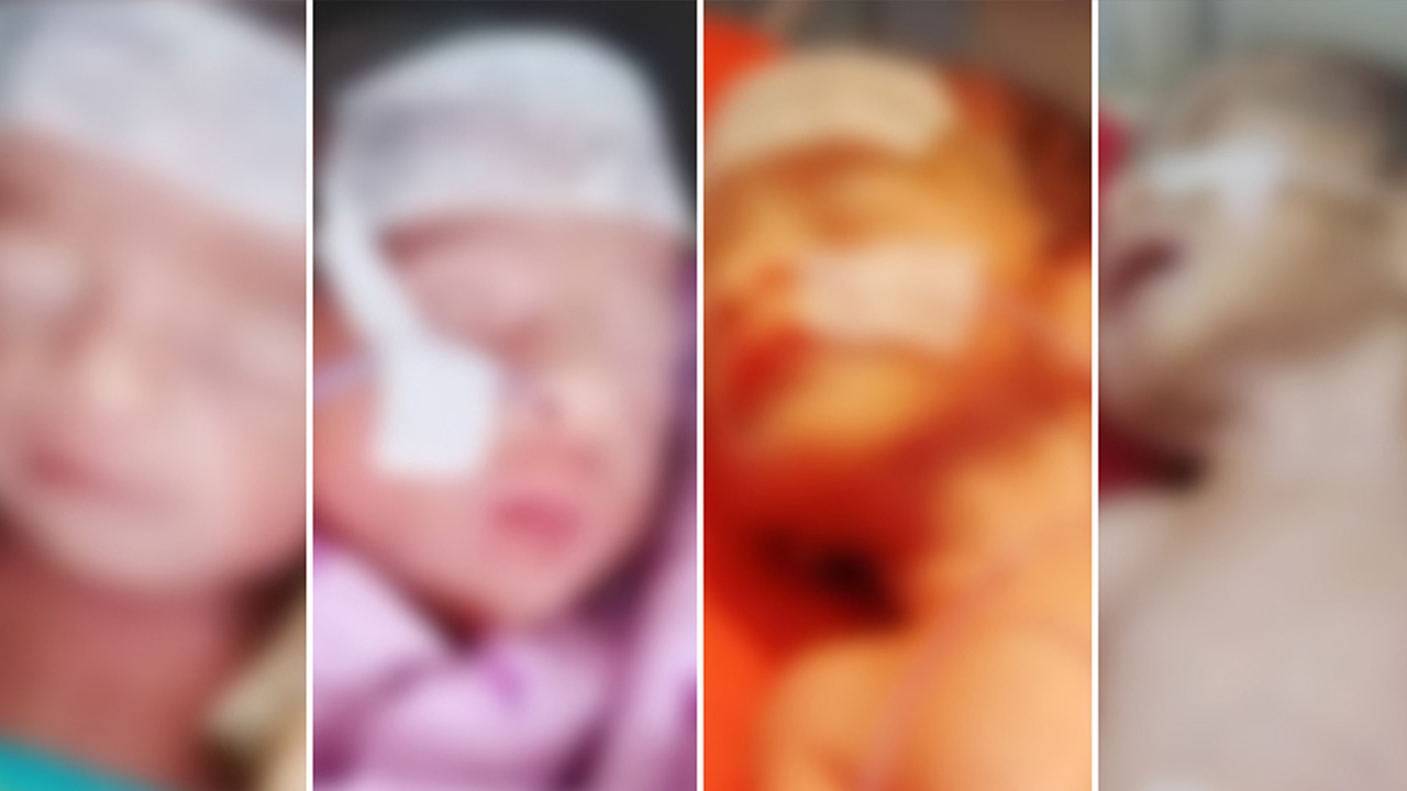 ঢামেকে জন্ম নেওয়া পাঁচ জমজ শিশুর মধ্যে বেঁচে থাকা চারজন। ছবি : সংগৃহীত