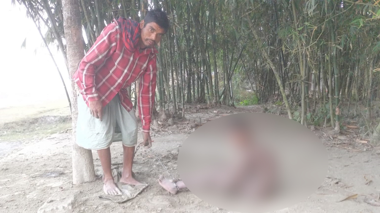 হারিয়ে যাওয়ার ভয়ে তার বাবা চার বছর ধরে দুই পায়ে শিকল পরিয়ে গাছের সাথে বেঁধে রাখছেন নিজ সন্তানকে। ছবি : কালবেলা