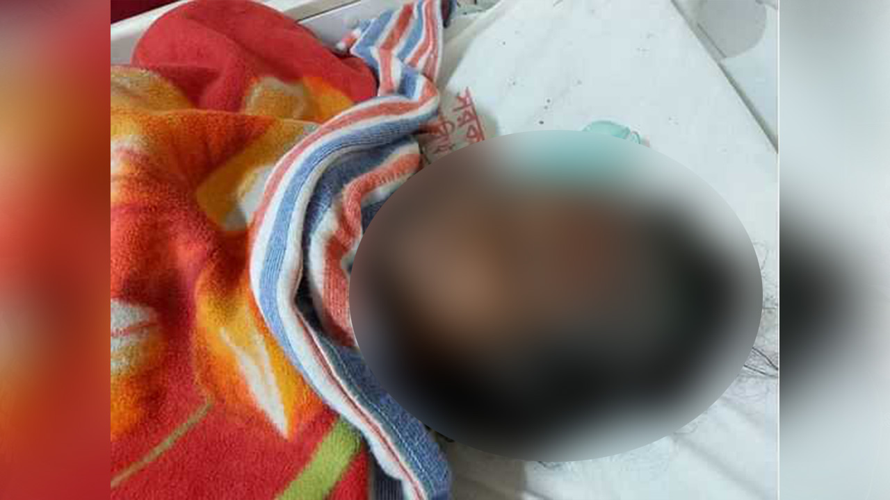 দুর্ঘটনার পর বুলু বেগমকে উদ্ধার করে রাজশাহী মেডিকেল কলেজ (রামেক) হাসপাতালে চিকিৎসা দেওয়া হয়। ছবি : কালবেলা