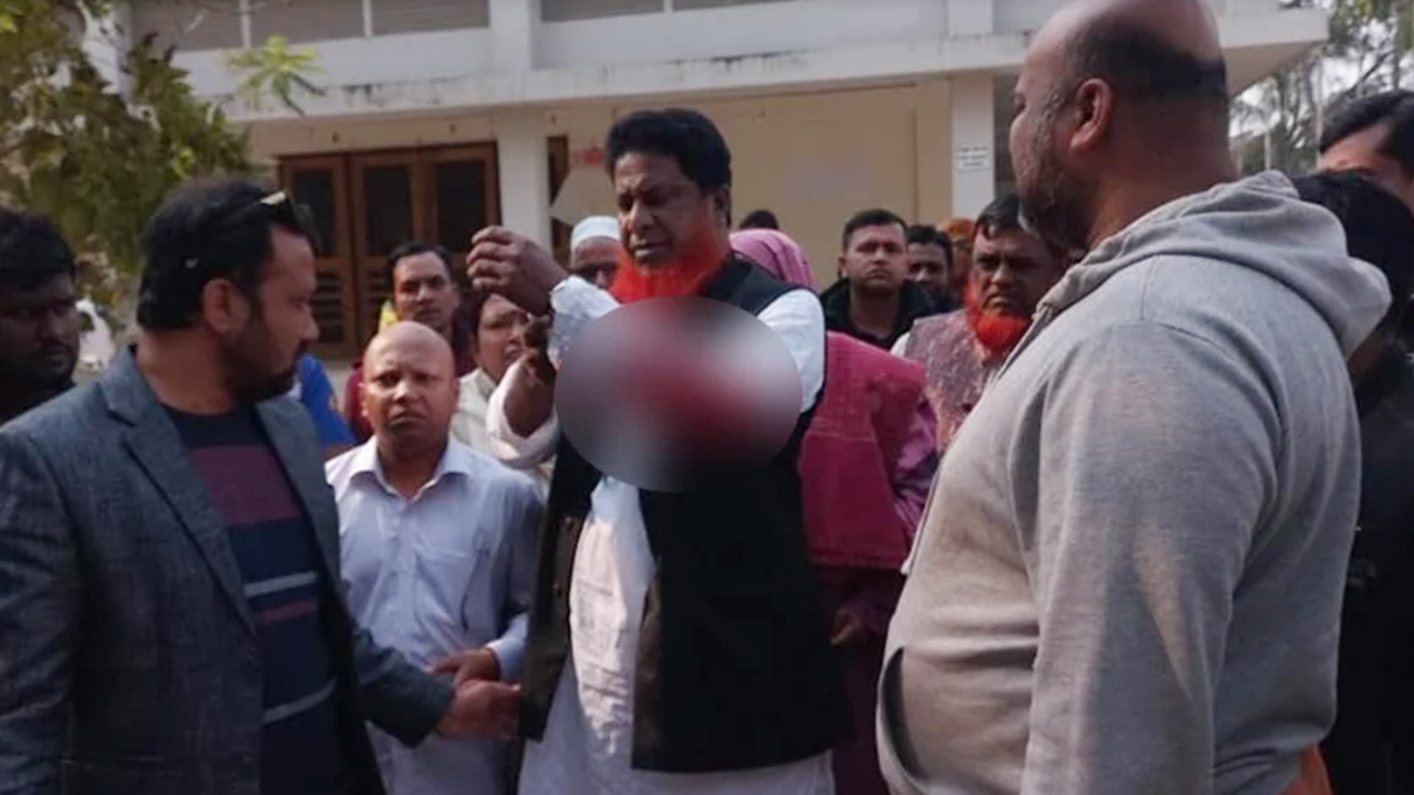 হাতুড়িপেটায় আহত আওয়ামী লীগ নেতা। ছবি : সংগৃহীত