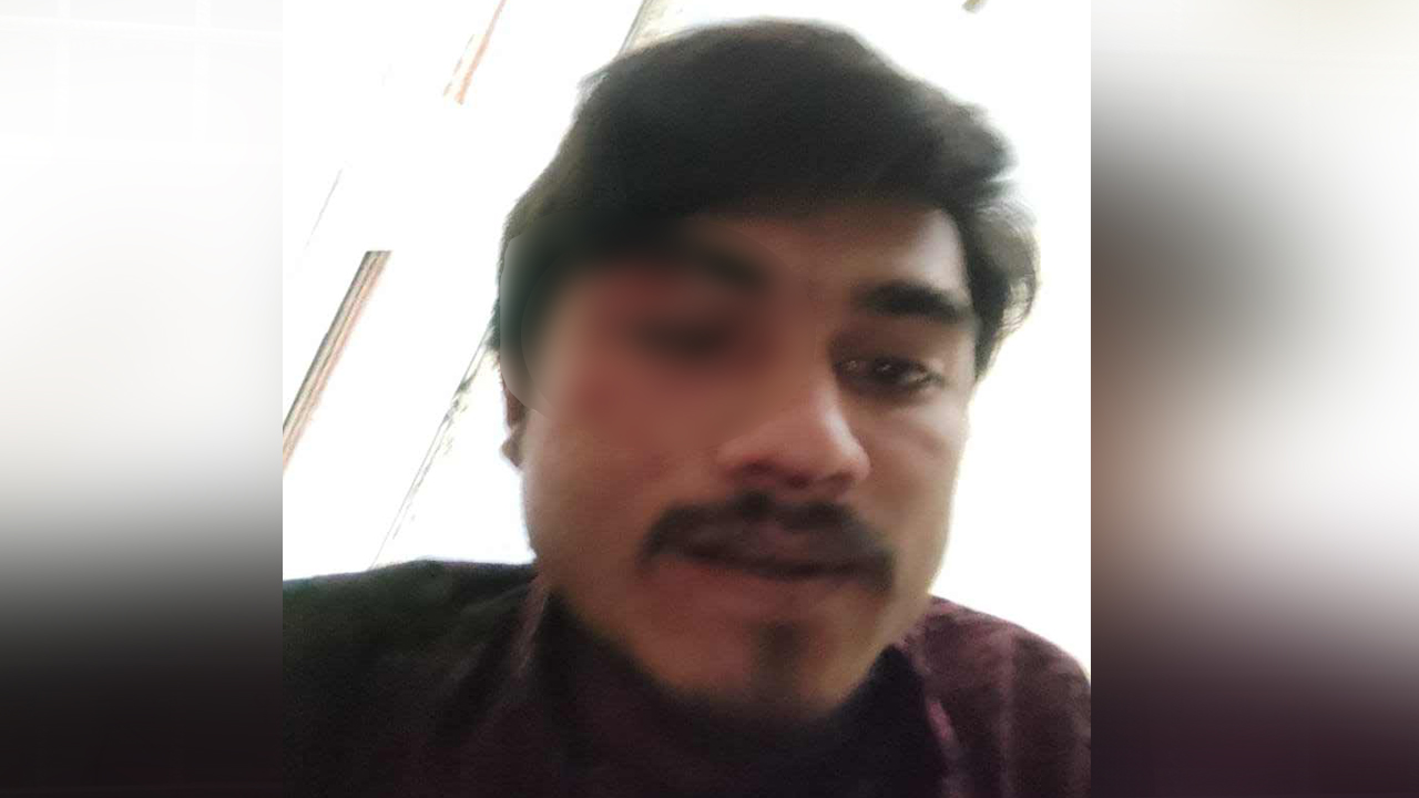 হামলার ঘটনায় চোখে মারাত্মক আঘাত পেয়েছেন সৈয়দ মোস্তফা সাদিক রিজভী। ছবি : কালবেলা