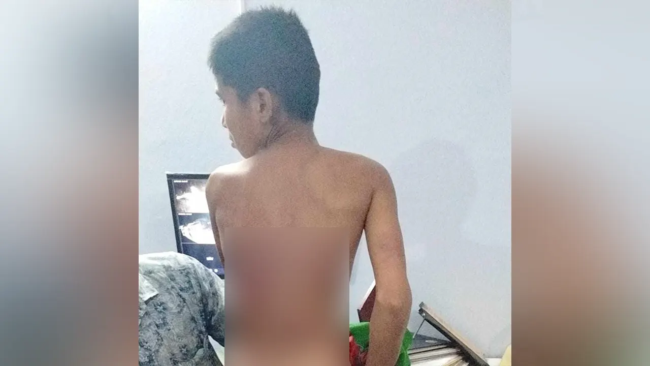 ভুক্তভোগী শিশু ছাত্র আব্দুল আলিম। ছবি : কালবেলা