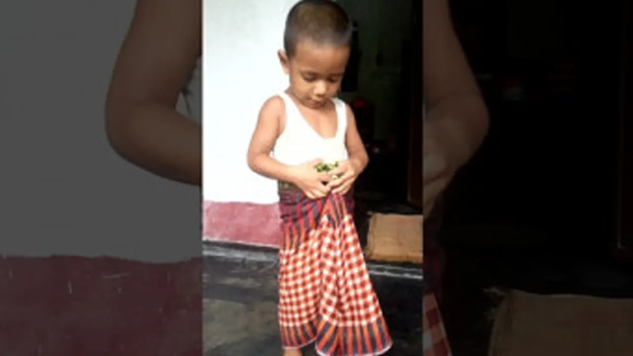 সুন্নাতে খতনার উপকারিতা ও বৈজ্ঞানিক ব্যাখ্যা
