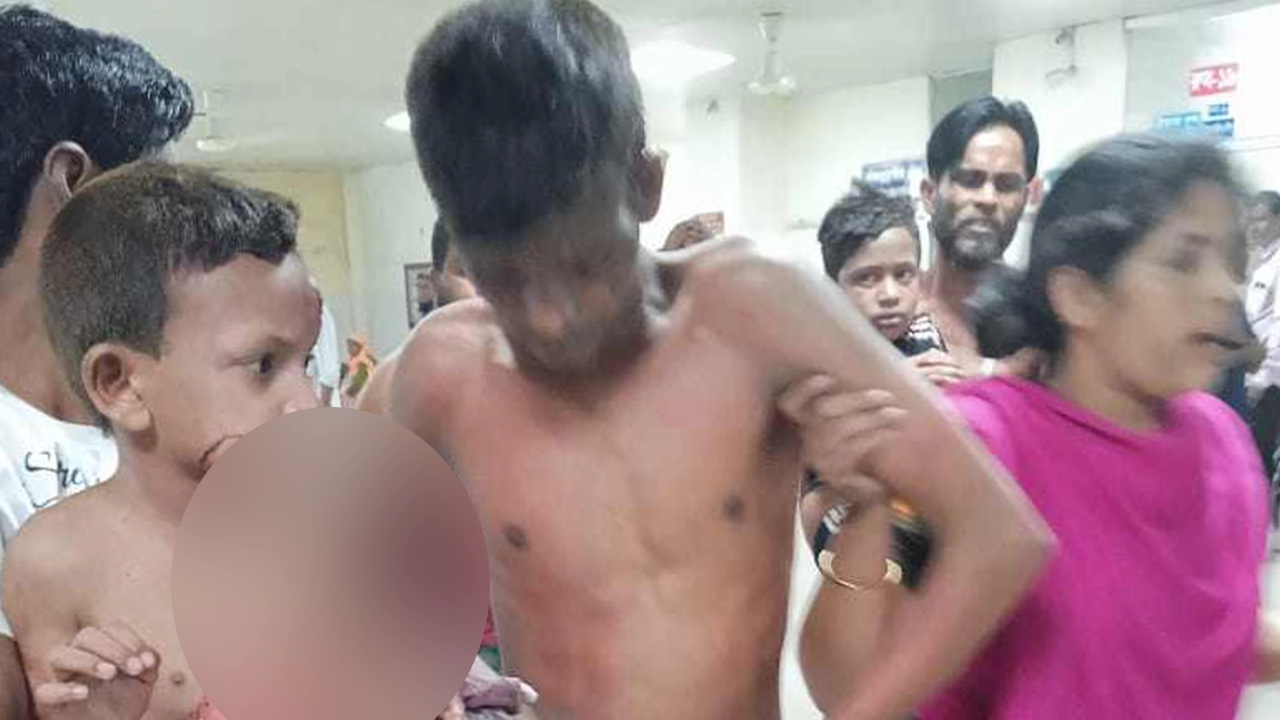 দগ্ধদের হাসপাতালে আনা হয়। ছবি : কালবেলা