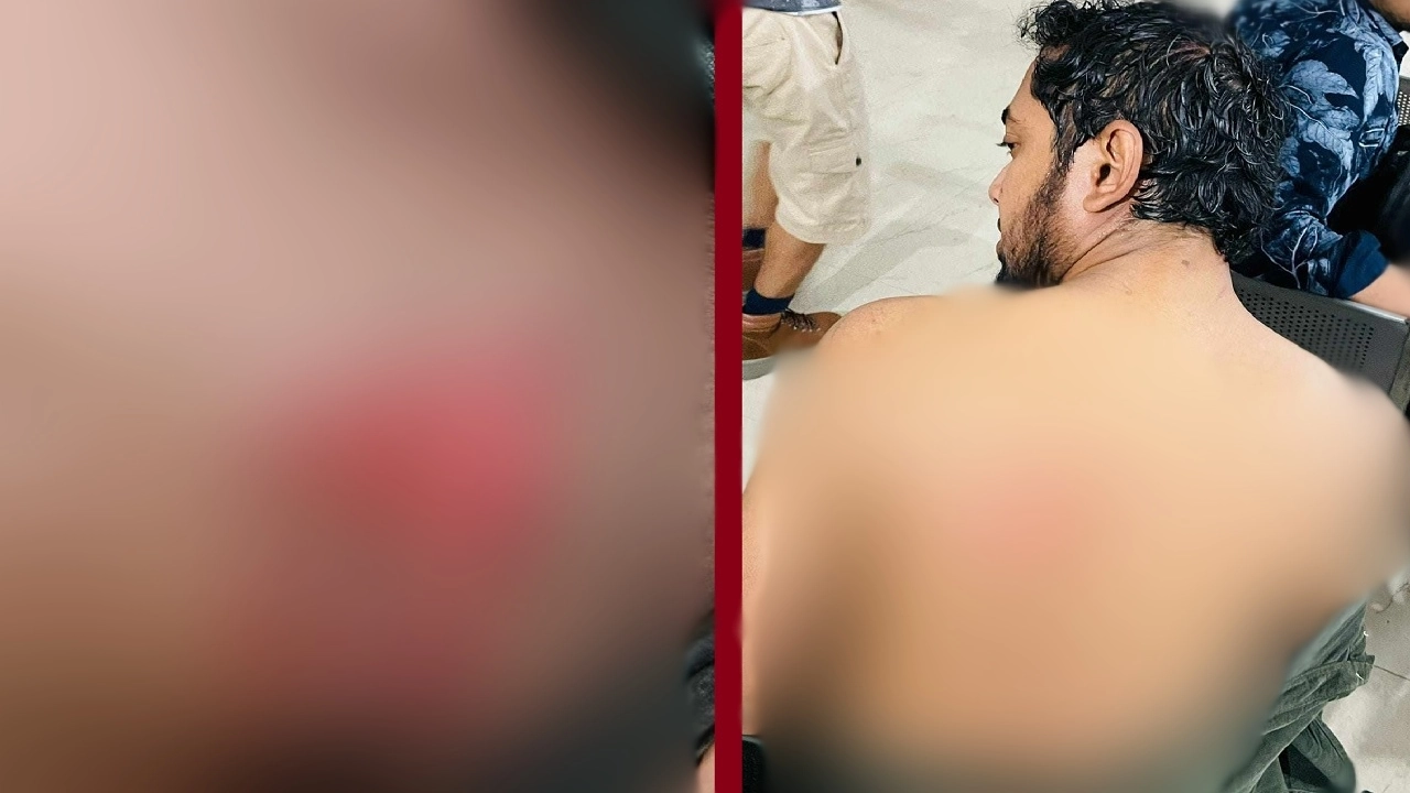 গুলশানে ফল বিক্রেতাদের হামলায় তিনজন আহত হয়েছেন। ছবি : কালবেলা