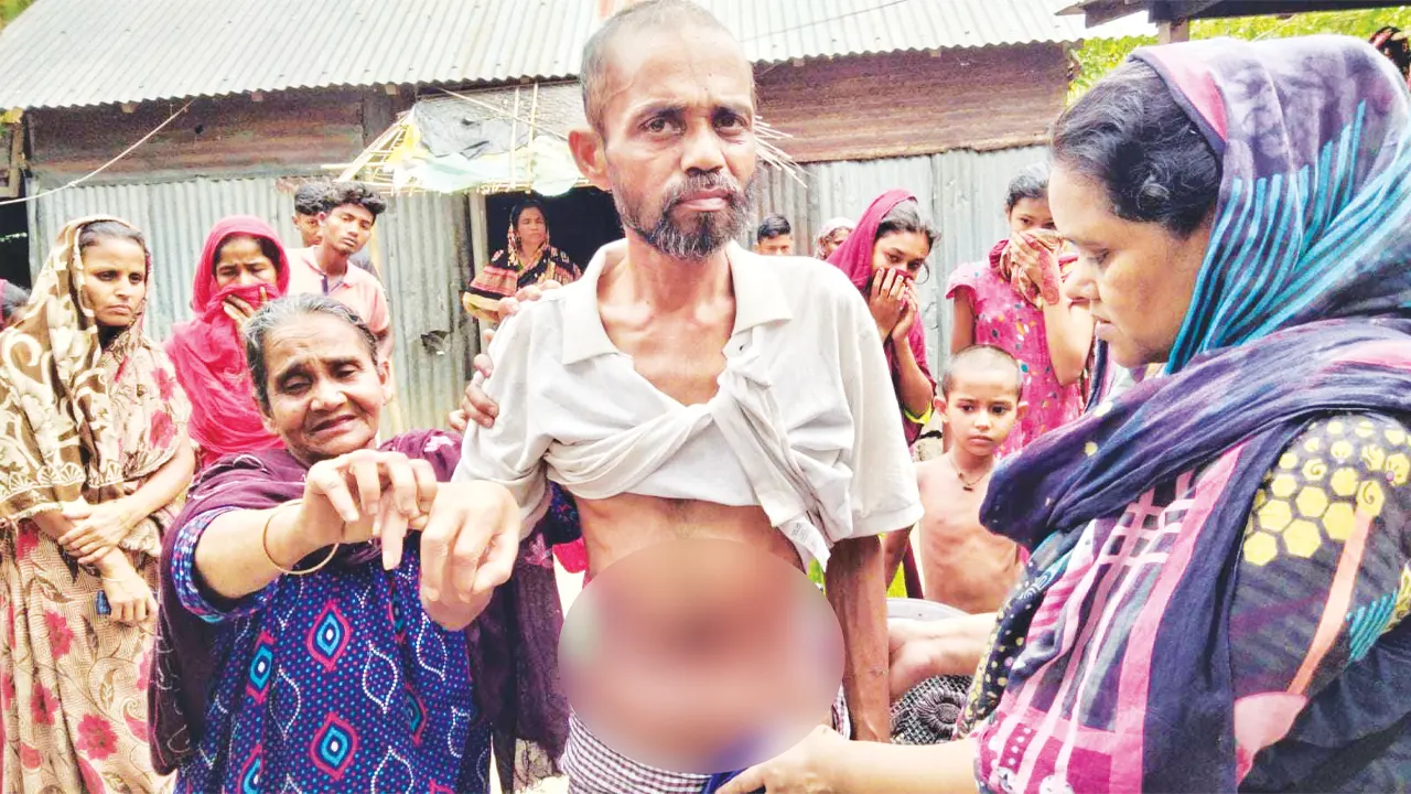 পেটে কাটা দাগ দেখে সেলিম মিয়ার কিডনি চুরির আশঙ্কা করেছিল তার পরিবার। ছবি: কালবেলা