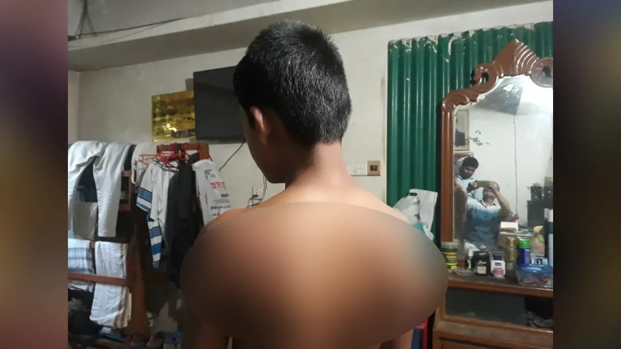 আহত মাদ্রাসাশিক্ষার্থী নৌরভ হাসান। ছবি : কালবেলা