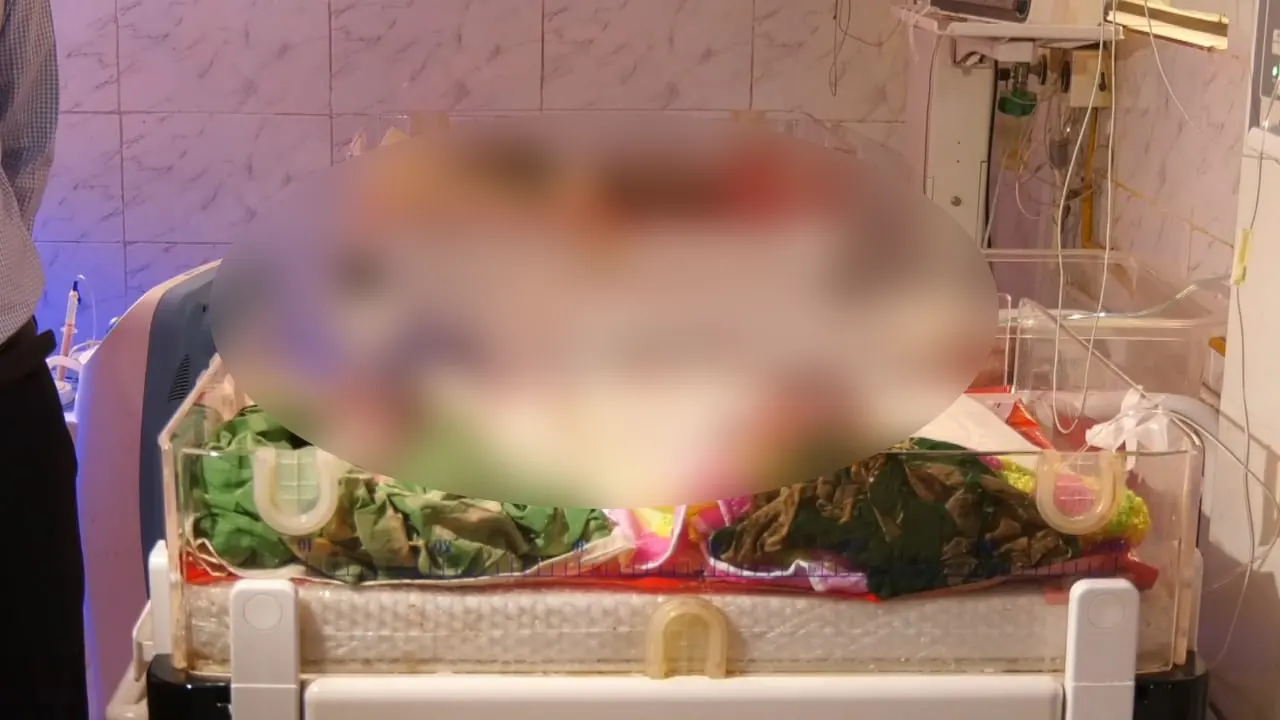 হাসপাতালে চিকিৎসাধীন চার নবজাতক। ছবি : কালবেলা