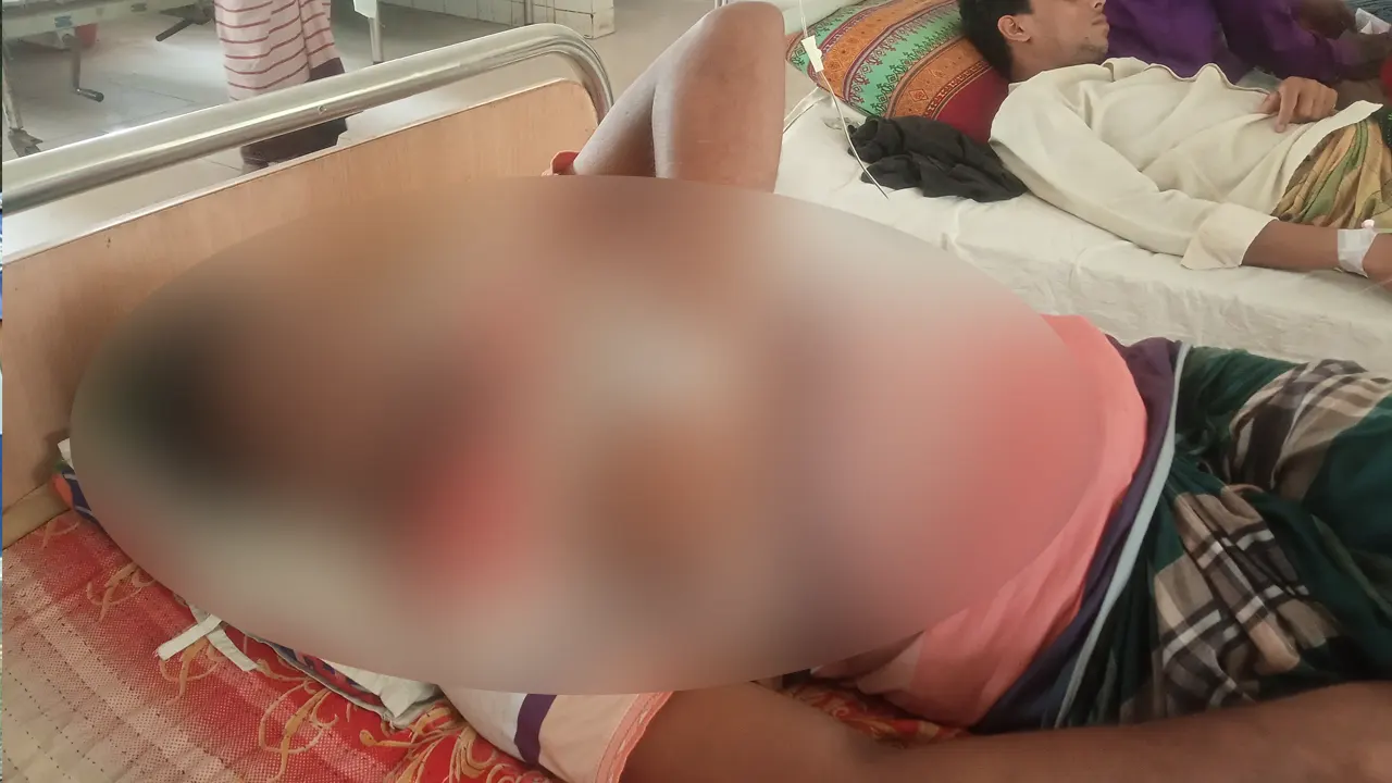 আহত সানাউল ইসলামকে উপজেলা স্বাস্থ্য কমপ্লেক্সে ভর্তি করা হয়েছে। ছবি : কালবেলা