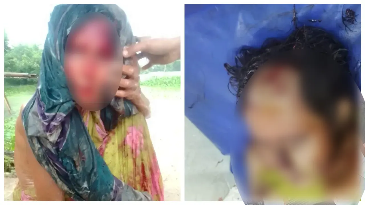 আহত মা-ছেলে। ছবি : সংগৃহীত