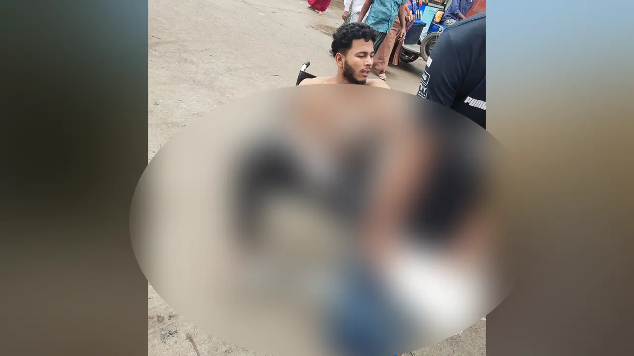 আহত বেলাল হোসেন ওরফে সাকিব। ছবি : কালবেলা