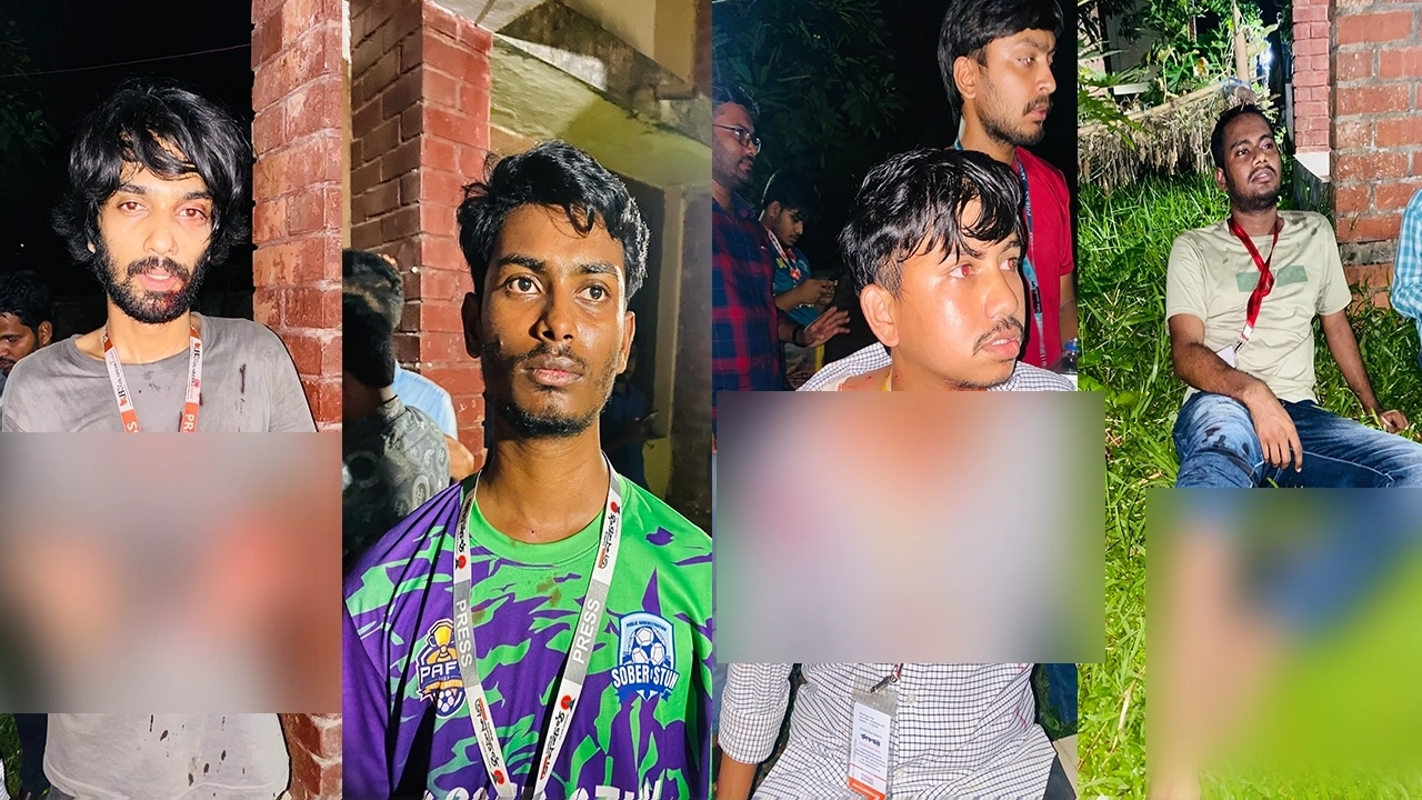জাহাঙ্গীরনগর বিশ্ববিদ্যালয়ের আহত সংবাদকর্মীরা। ছবি : কালবেলা