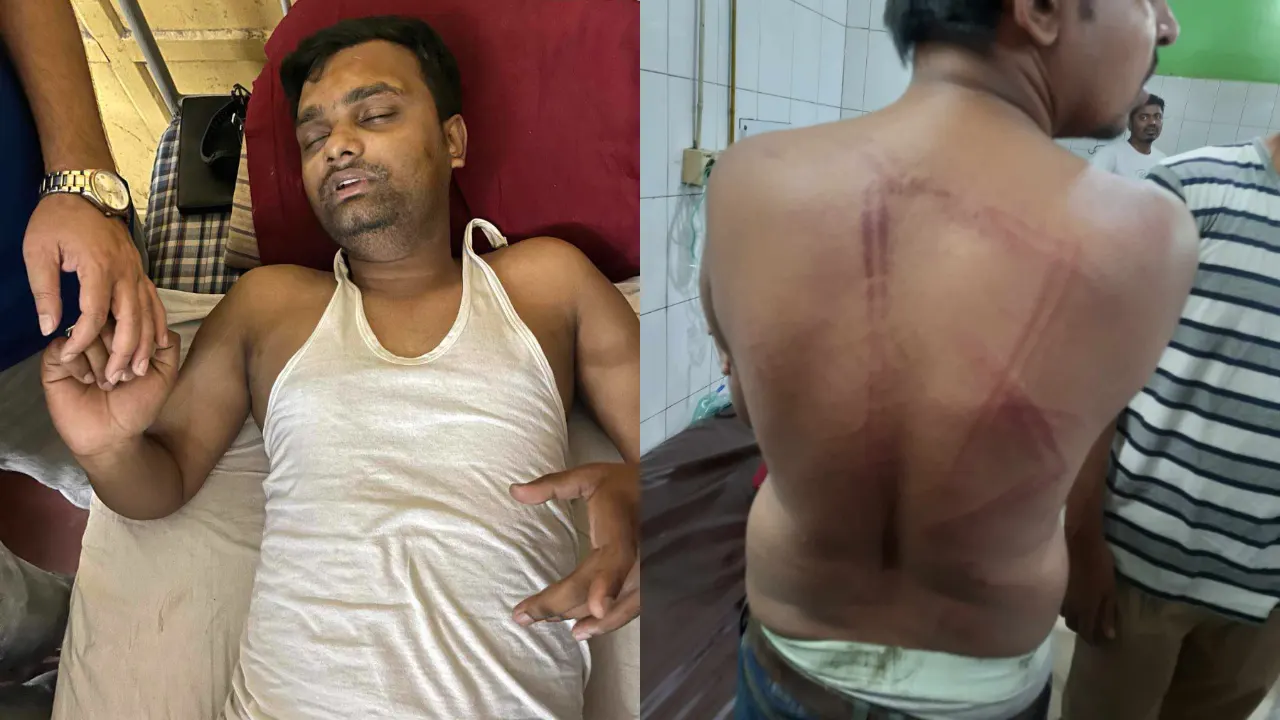আহত সাংবাদিক সাদী ভূঁইয়া ও নাহিদ সাব্বির। ছবি : কালবেলা