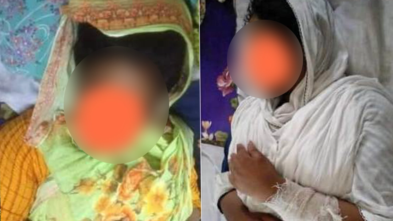 হাসপাতালে চিকিৎসাধীন দুই বোন। ছবি : কালবেলা