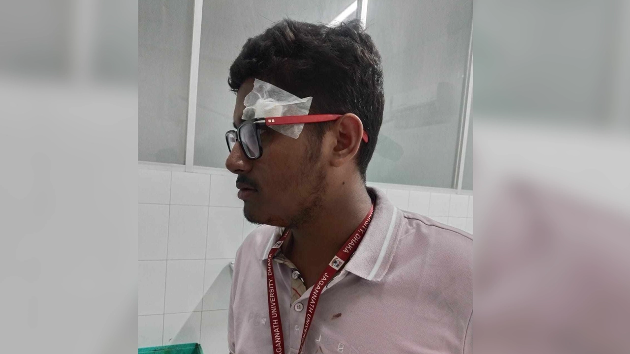 আহত শিক্ষার্থী কামারুজ্জামান কায়েস। ছবি : কালবেলা