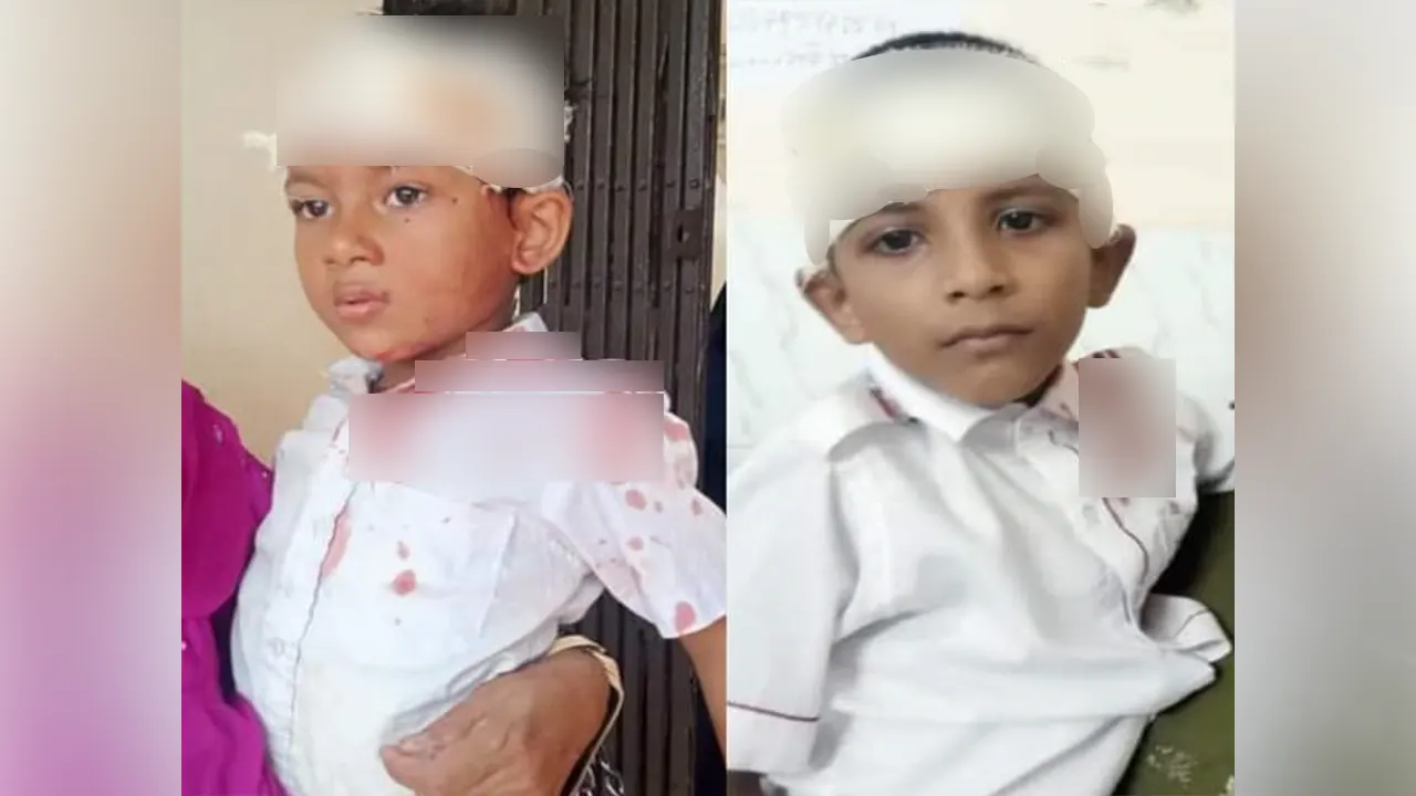 বিদ্যালয়ে চলন্ত ফ্যান খুলে পড়ে আহত দুই শিক্ষার্থী। ছবি : কালবেলা