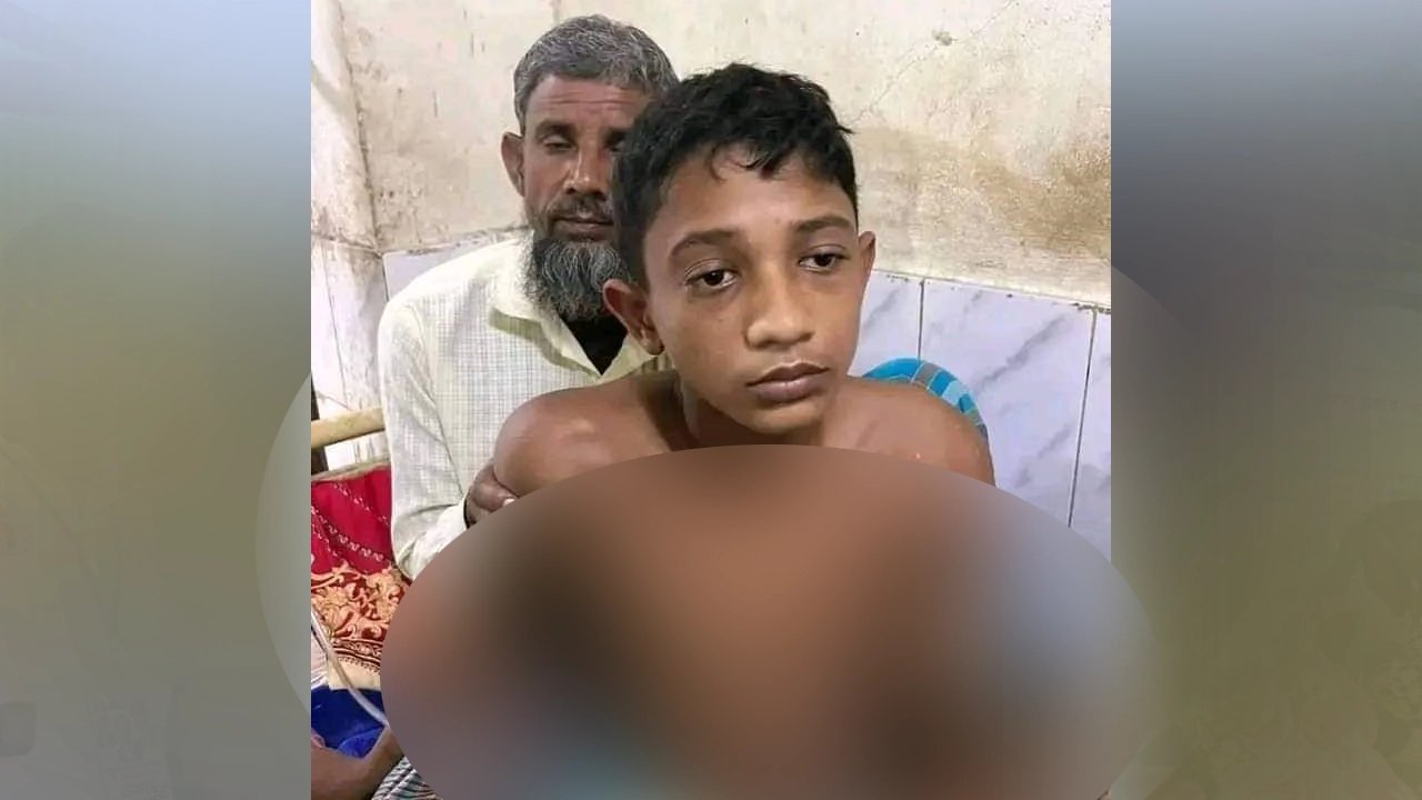হাসপাতালে চিকিৎসাধীন ট্রেনের ধাক্কায় আহত লিখন। ছবি : সংগৃহীত