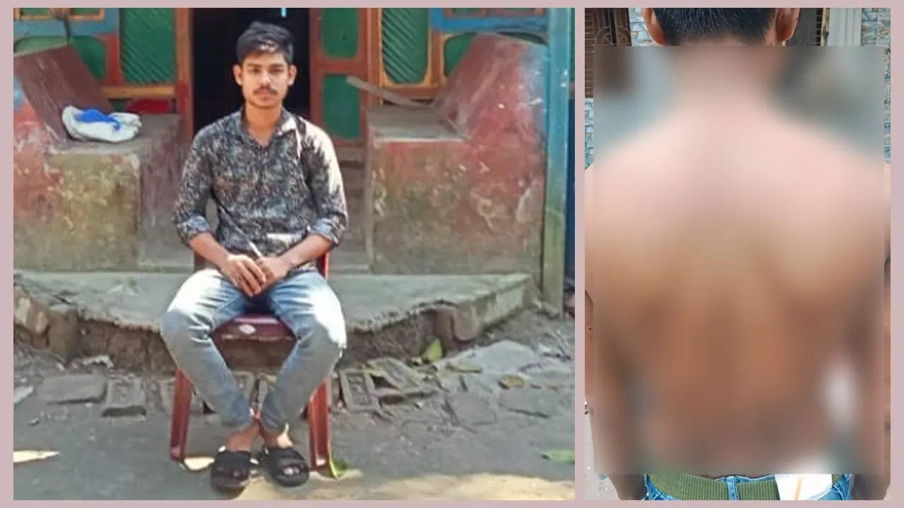 অসহনীয় ব্যথা ও যন্ত্রণা নিয়ে বাড়িতেই কাটছে জানে আলমের দিন। ছবি : কালবেলা