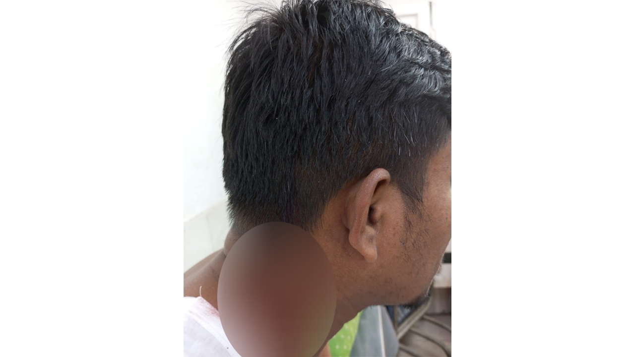 আহত বিএনপি কর্মী। ছবি : কালবেলা