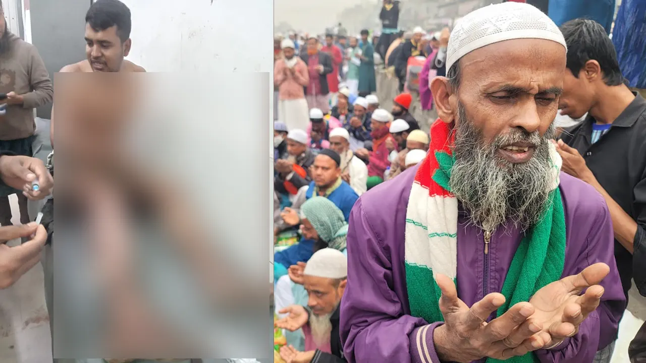 বাঁ থেকে- ইজতেমায় গরম পানিতে পড়ে আহত ব্যক্তি জুয়েল ও আখেরি মোনাজাতে মুসল্লিরা। ছবি : কালবেলা