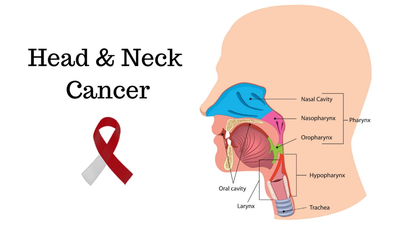 গলা ও মুখের ক্যানসারে যুগান্তকারী সাফল্য