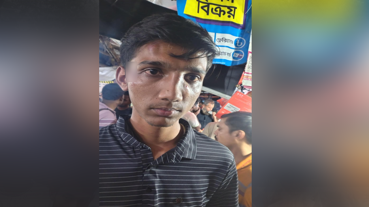 ভুক্তভোগী ব্যক্তি। ছবি : সংগৃহীত