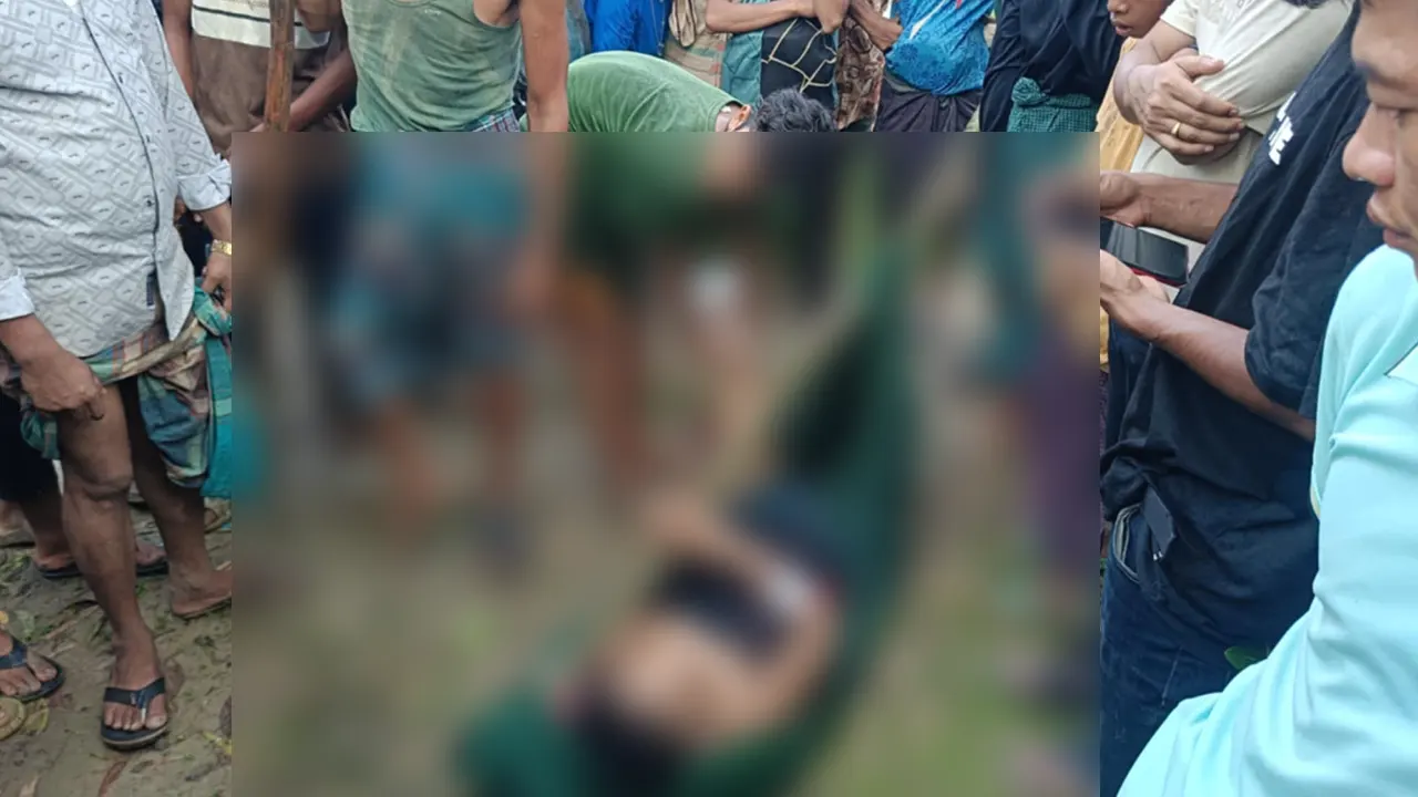 বান্দরবানের নাইক্ষ্যংছড়ির ঘুমধুম সীমান্তে মিয়ানমারের অভ্যন্তরে মাইন বিস্ফোরণে তংচংগ্যা নামে এক রাখাইন যুবকের বাম পা বিচ্ছিন্ন হয়ে গেছে। ছবি : কালবেলা