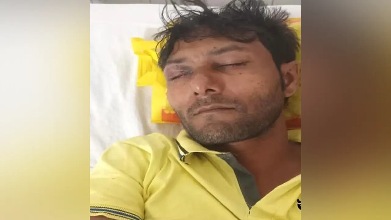 হাসপাতালে চিকিৎসাধীন ঘের মালিক আলমগীর হোসেন। ছবি : কালবেলা