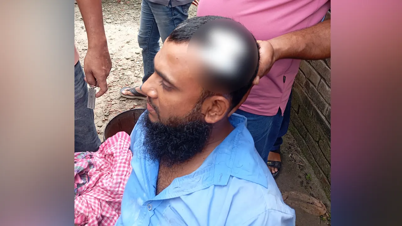 আহত লাইনম্যান সোহাগ মিয়া। ছবি : কালবেলা