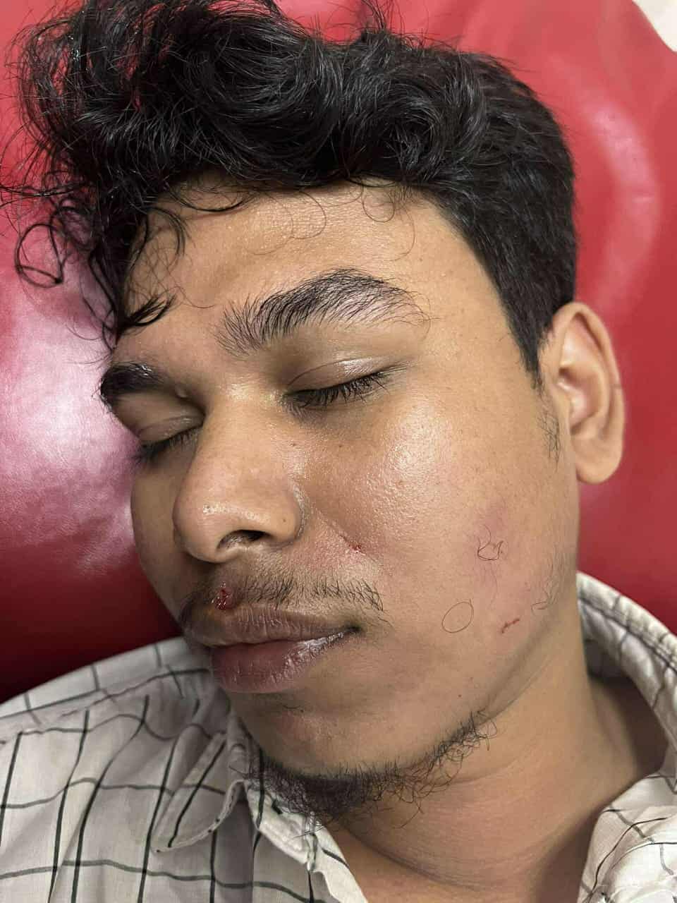 হামলা আহত দৈনিক কালবেলার বাঙলা কলেজ প্রতিনিধি সাইফুল ইসলাম সাব্বির।