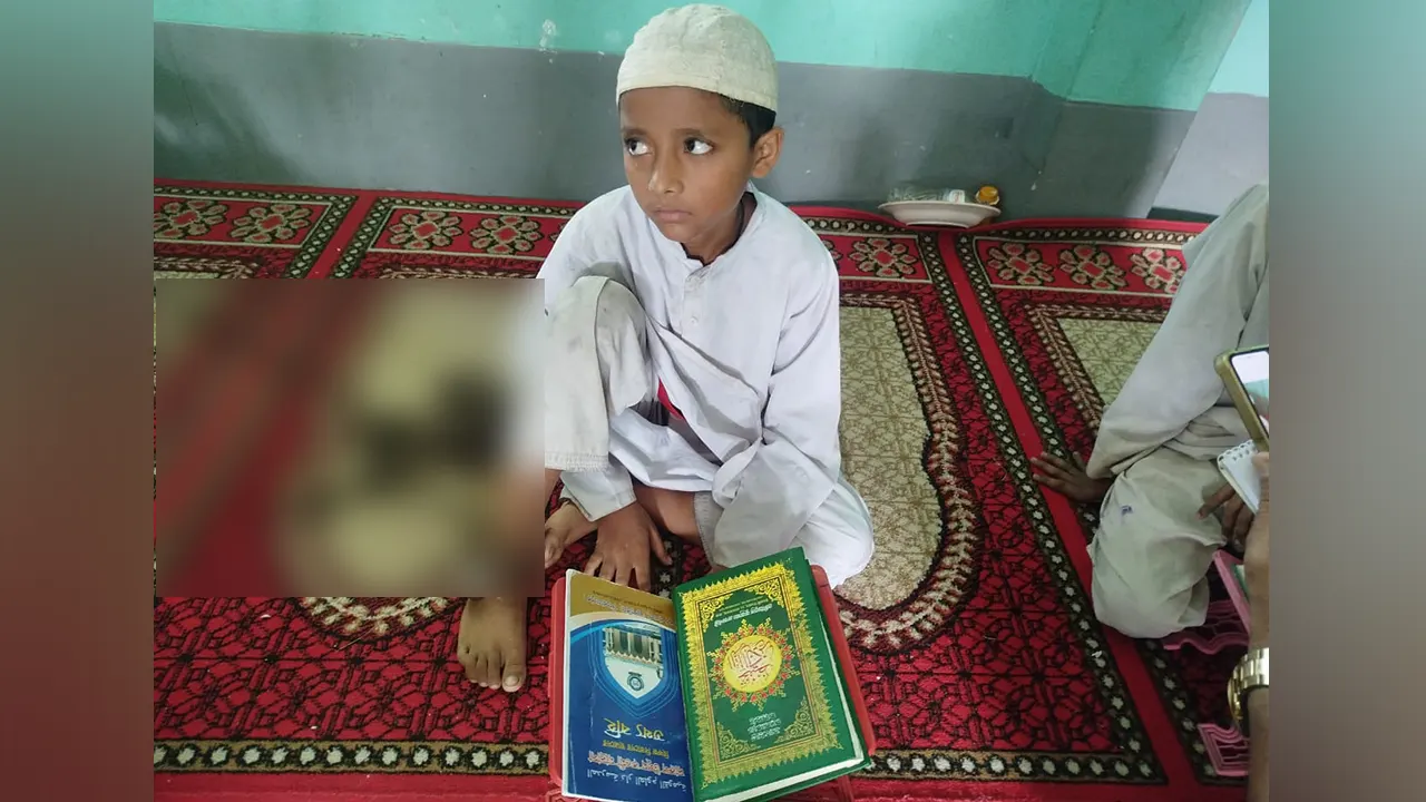 মাদ্রাসা থেকে পালিয়ে বাড়ি যাওয়ায় পায়ে শিকল বেঁধে শিশুর পাঠদান